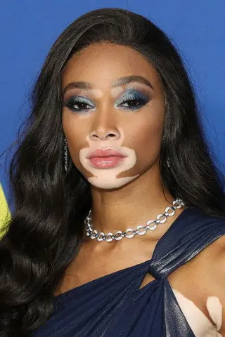 Winnie Harlow - Filmography • Carriera
